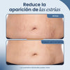 Crema Reafirmante Antiestrias para Abdomen